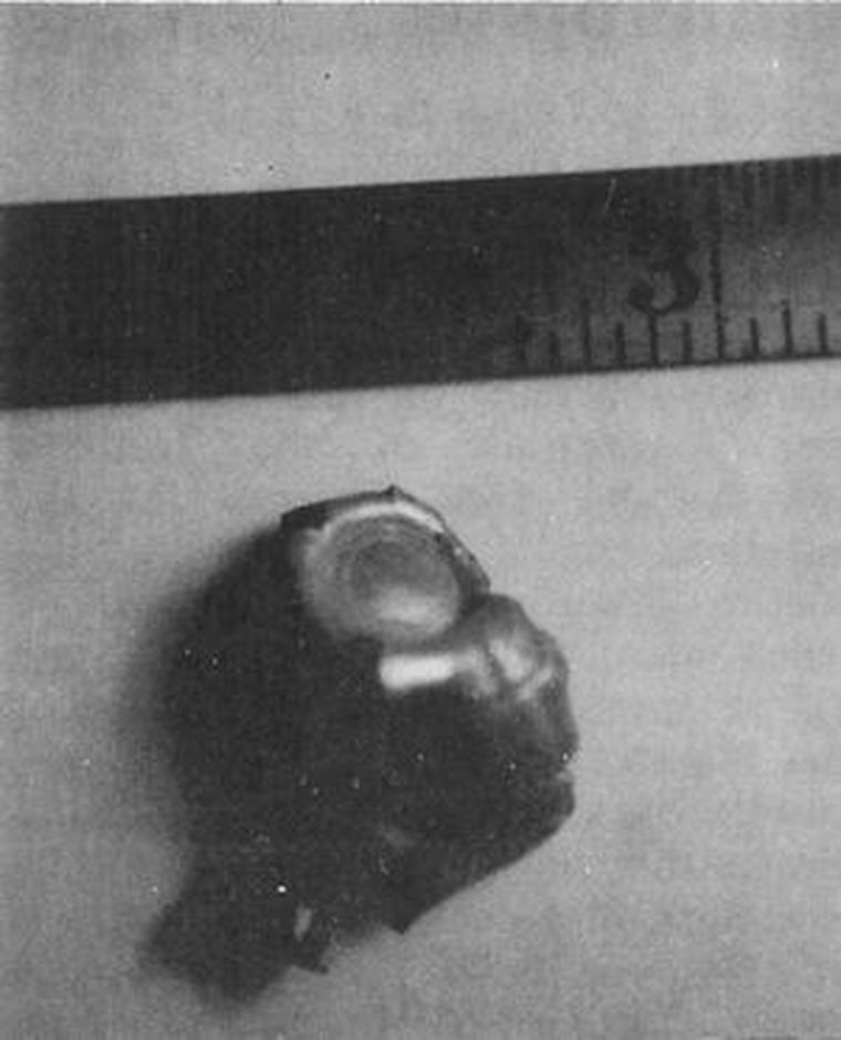 The Carl Higdon Abduction