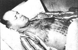 The Falcon Lake Incident