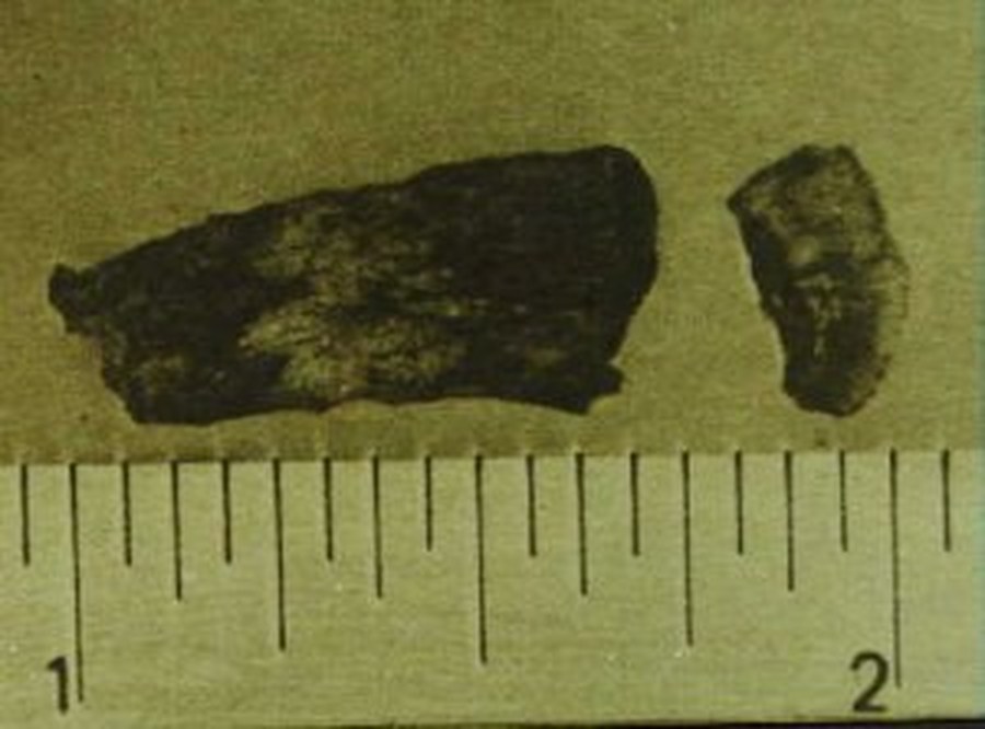 The Ubatuba Magnesium Fragments
